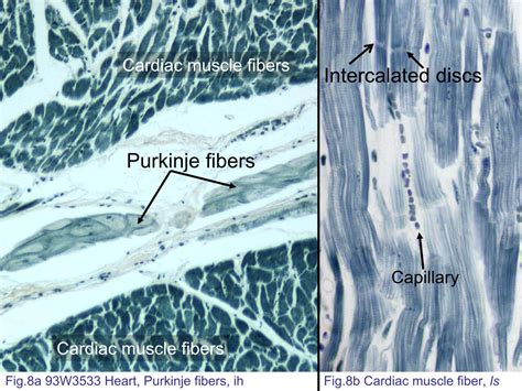 Purkinje Fibers Histology