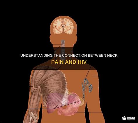 Understanding The Connection Between Neck Pain And Hiv Medshun