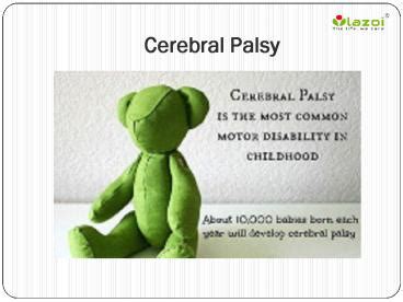 PPT Cerebral Palsy Symptoms Causes Diagnosis And Treatment