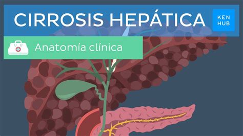 Cirrosis Hep Tica Definici N Presentaci N Cl Nica Diagn Stico