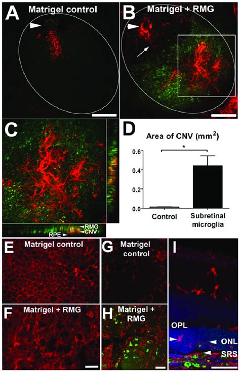 In Vivo Subretinal Transplantation Of Retinal Microglia Promotes