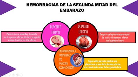 Mapa Mental Hemorragias De La Segunda Mitad Del Embarazo Nutriva Udocz