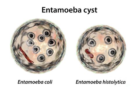 Cysts Of Entamoeba Protozoans 1 By Science Photo Library