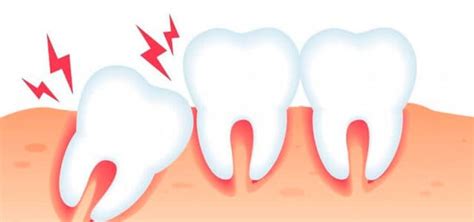 Luxaci N Dental Qu Es Y C Mo Se Trata Ferrus Bratos