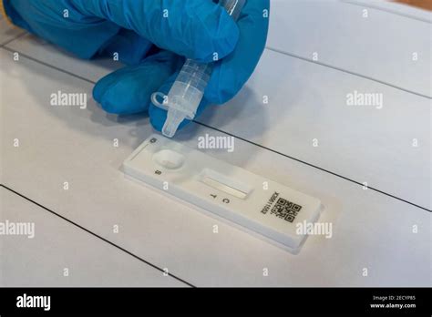 Prueba cualitativa rápida fotografías e imágenes de alta resolución Alamy