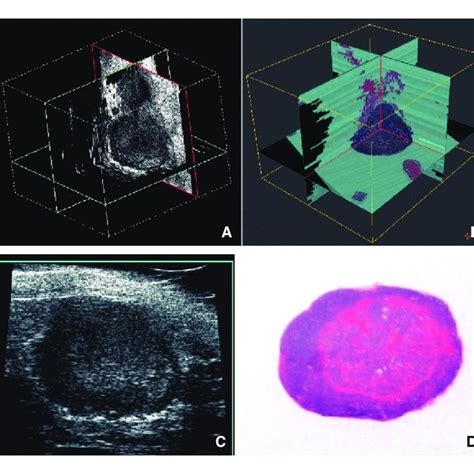 Three Dimensional Ultrasound Image Of A Genetically Engineered Mouse