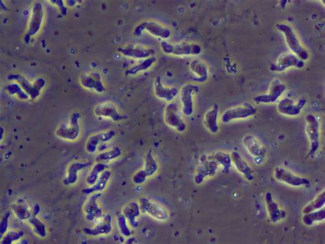 Not Cias Ameba Comedora De C Rebros Saiba Tudo Sobre A Naegleria