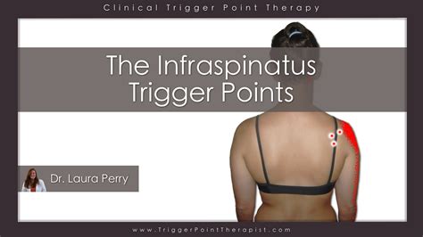 Trigger Point Video For Infraspinatus Muscle