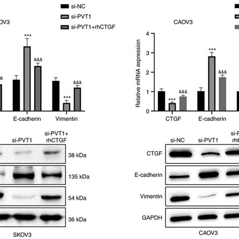 Pvt Regulates The Expression Of Emt Related Proteins Via Ctgf Ctgf