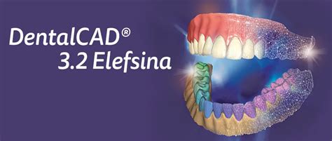 Exocad Introduces Dentalcad Elefsina Software With More Than New