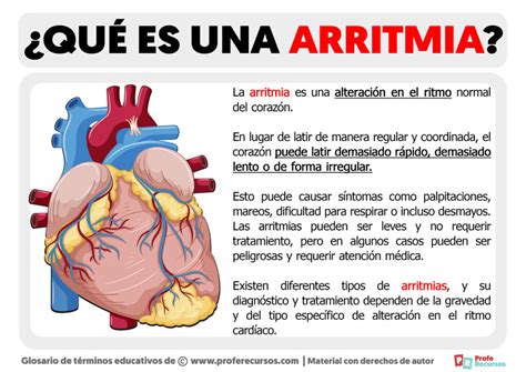 Qué es una Arritmia Definición de Arritmia