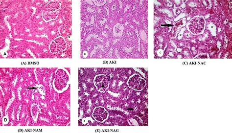 Label The Photomicrograph Based On The Hints Provided Glomerulus Of