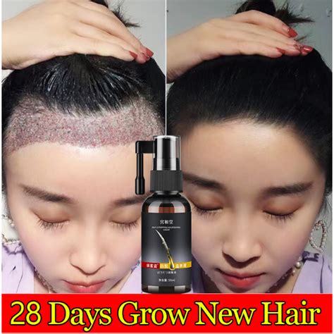 Hair Growth Serum 50ml Anti Hair Loss Preventiom For Men And Women Hair Tonic Hair Treatment