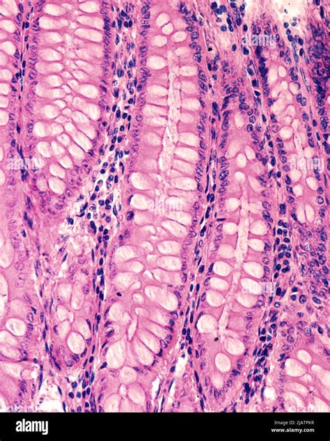 Mucosal Crypts In Human Colon Light Micrograph Stock Photo Alamy