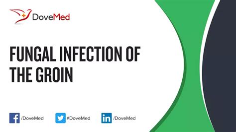 Fungal Infection Of The Groin Dovemed