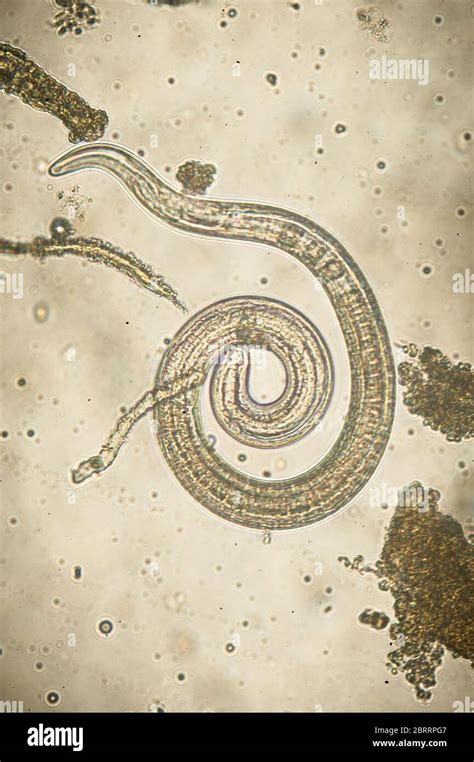 Trichinella Spiralis Adult