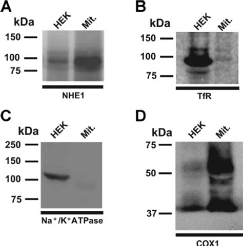 Expression of NHE1 Na ϩ H ϩ exchanger Na ϩ K ϩ ATPase transferrin