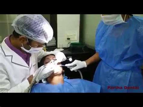 Advance Treatment For Gaps Between Teeth At Partha Dental YouTube