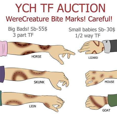 Bite Mark Tf Auction By Detectivecoon Fur Affinity Dot Net