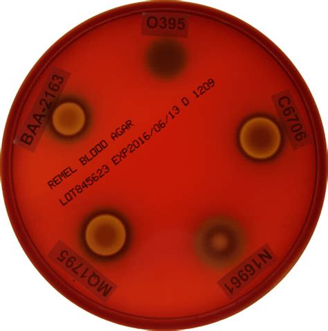 Measuring Hemolytic Activity Using Blood Agar Media Hemolytic Activity