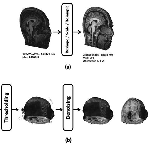 Brainchop Preprocessing Pipeline A Conform Operation B Mri