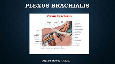 SOLUTION Plexus Brachialis Studypool