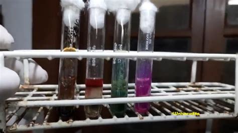 Common Bacteria Biochemical Test Demonstration Introduction Common