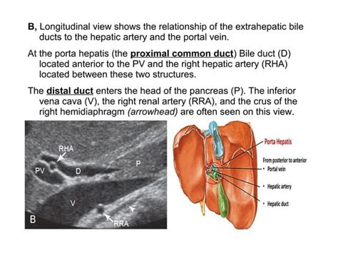 Bile Duct Ultrasound Ppt