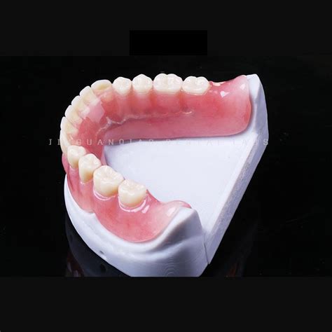 denture precision attachment mk cosmetically enhanced cast partial