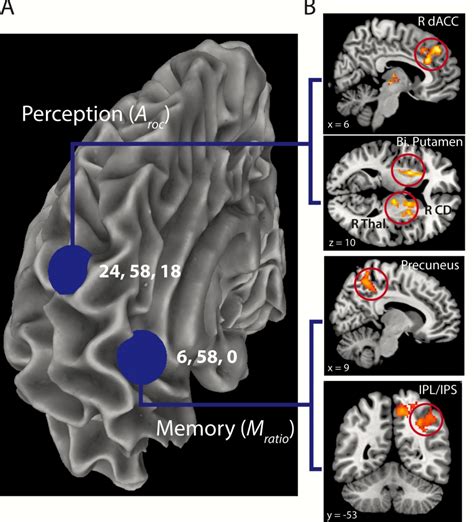 Research Reveals Brain Connections Underlying Accurate Introspection ...