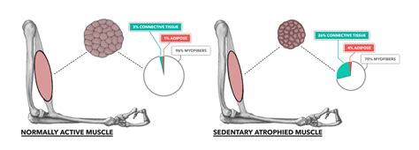 CrossFit | Muscle Basics, Part 4: Atrophy & Sarcopenia