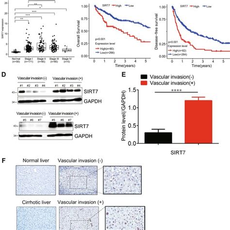 Elevated SIRT7 Expression In Human HCC And Associated With Poor