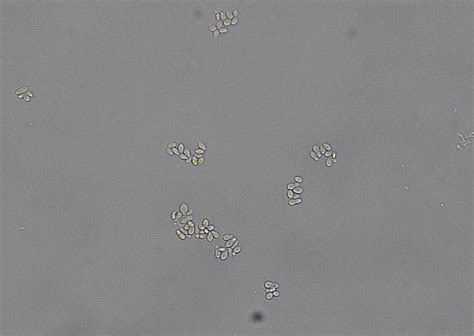 Urine Infectious Agents Eclinpath