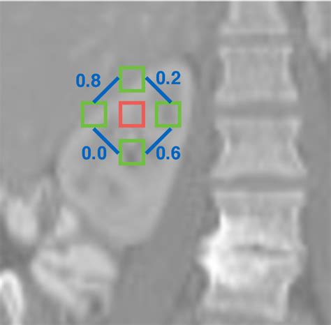 Figure From Optimisation Of Regularisation Parameter Of Least