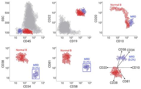 Measurable Residual Disease In Acute Lymphoblastic Leukemia Methods