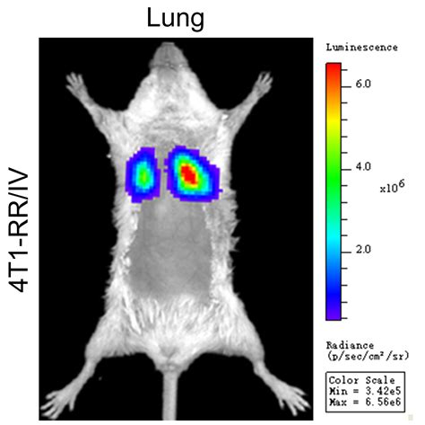 Dual Bioluminescence Imaging Of Tumor Progression And Angiogenesis