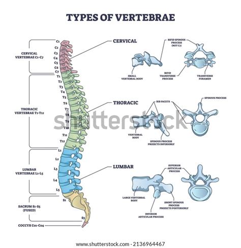 25 Bifid Spine Images, Stock Photos & Vectors | Shutterstock