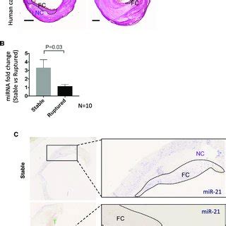 Decreased Mir Expression Is Associated With Atherosclerotic Fibrous