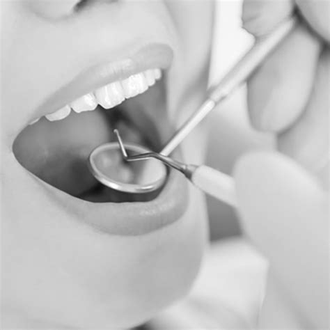 Curetaje dental Qué es precio y proceso sMySecret