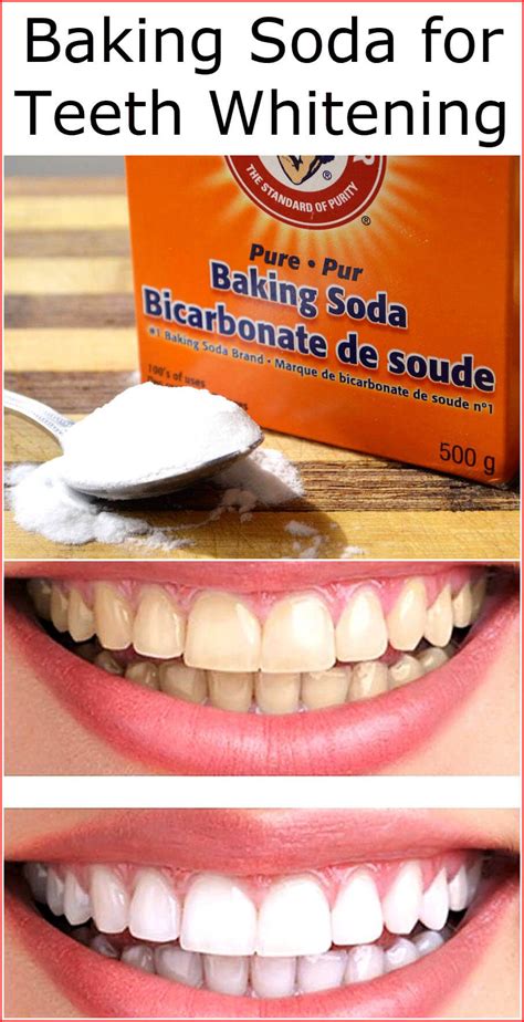 Baking Soda for Teeth Whitening | Baking Soda Uses and DIY Home Remedies.