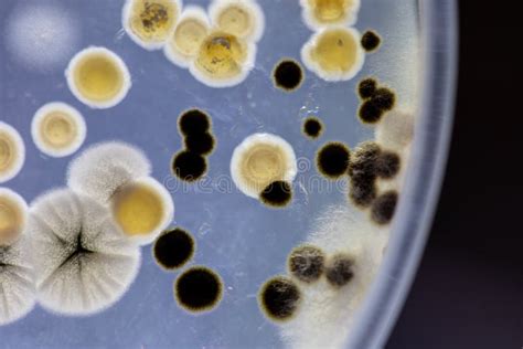 Different Shaped Colony Of Bacteria And Mold Growing On Agar Plates