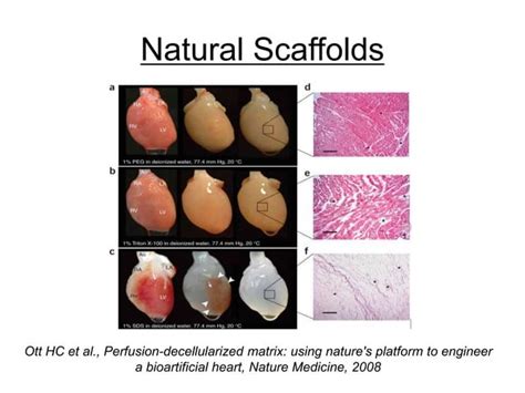 Tissue Engineering And Regenerative Medicine Ppt