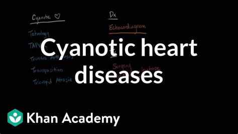 Cyanotic Heart Diseases Diagnosis And Treatment Nclex Rn Khan