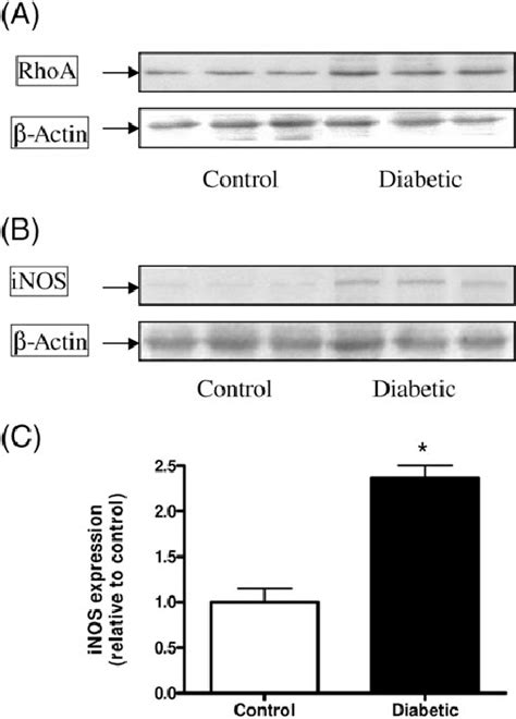 Rhoa And Inducible Nitric Oxide Synthase Expression In Cardiomyocytes