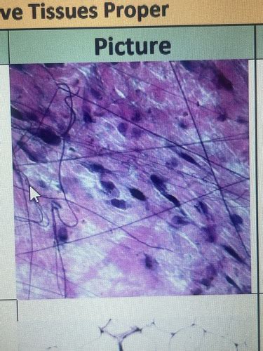 Connective Tissues Flashcards Quizlet