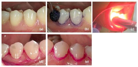 Antibiotics Free Full Text Application Of Different Wavelengths Of Led Lights In