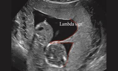 Isuog Practice Guidelines Updated Performance Of Off