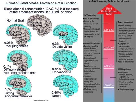 Alcoholic Brain