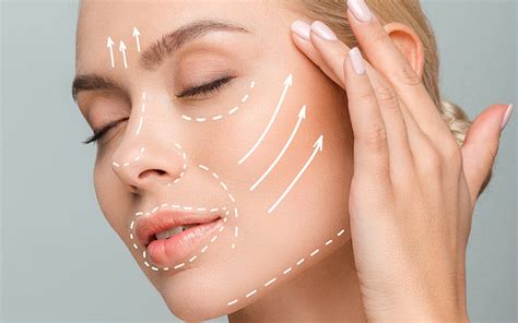 En qué consiste el lifting facial Intervención recuperación y precio