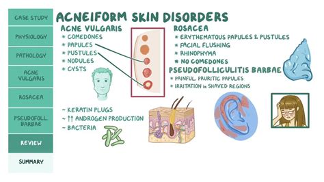 Acneiform Skin Disorders Pathology Review Video Osmosis